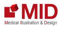 MID